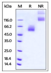 Rat CD47, Fc Tag on SDS-PAGE under reducing (R) and non-reducing (NR) conditions. The gel was stained overnight with Coomassie Blue. The purity of the protein is greater than 95%.